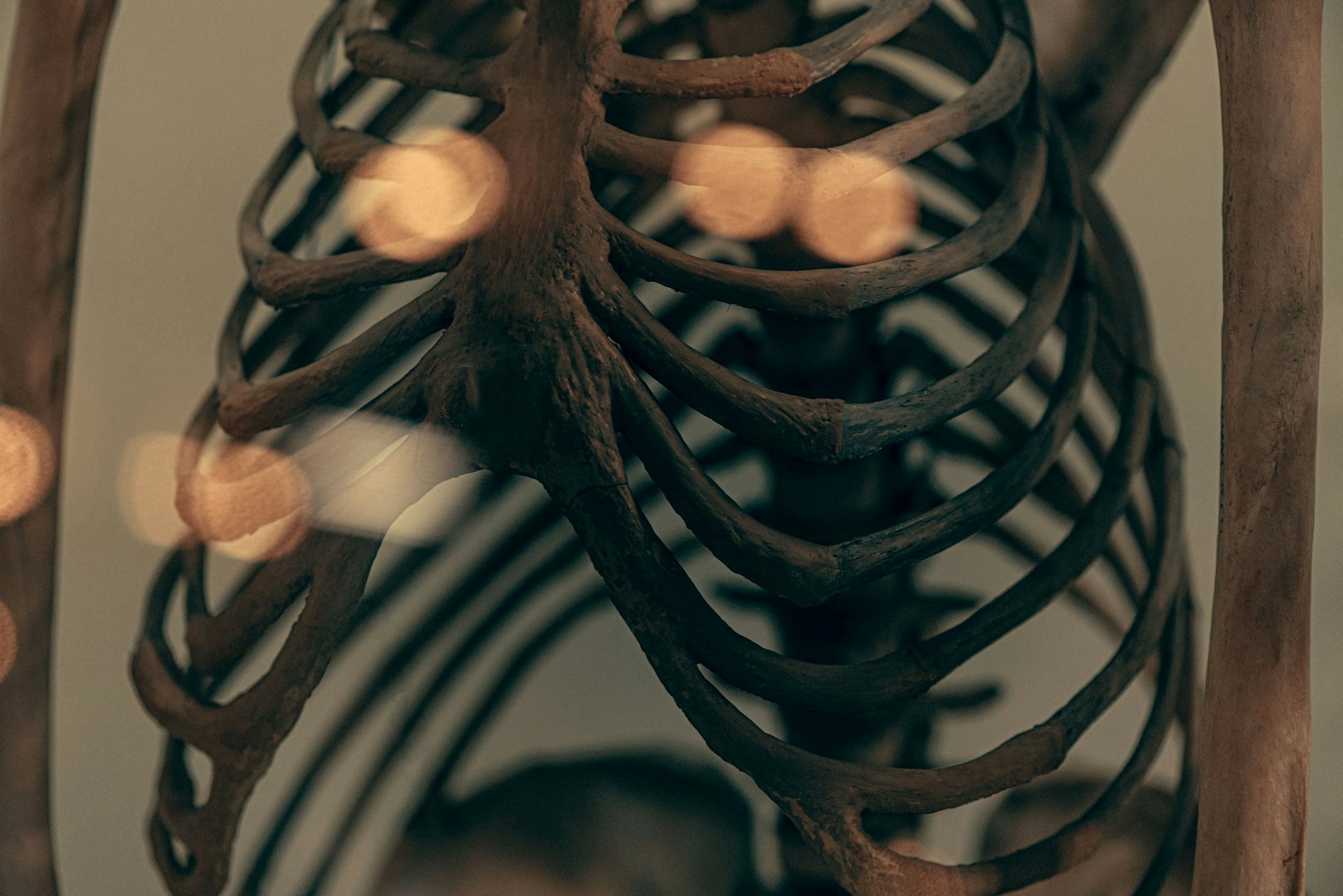 Bones